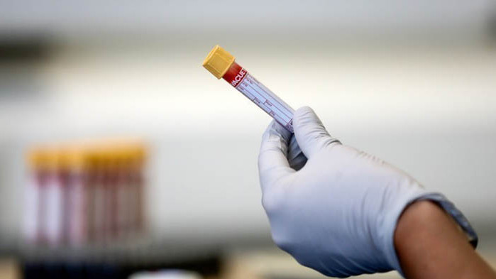 Футболист на Царско село е с положителен тест за COVID-19